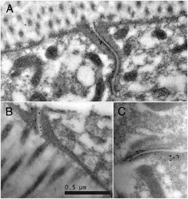 EMMicrowaveIFIG 1: ImmunoEM after microwave fixation.